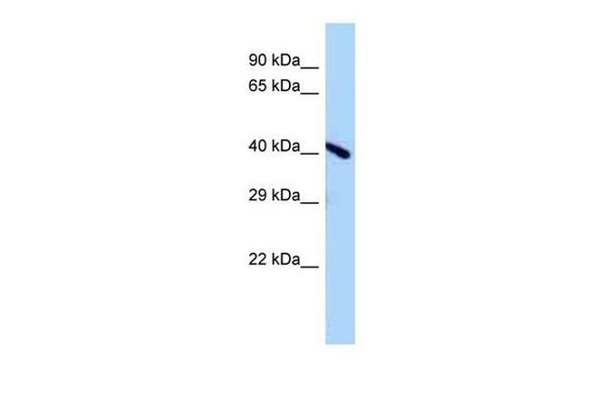 Endov Antibody in Western Blot (WB)