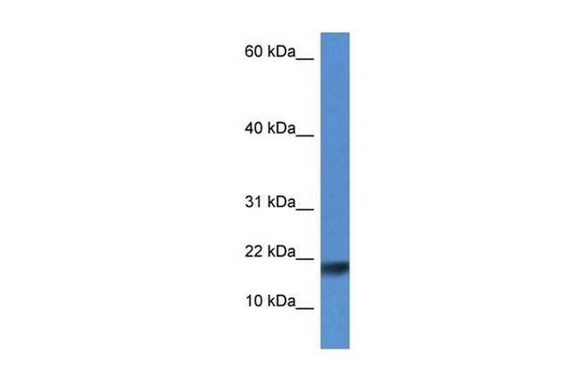 ISCU Antibody in Western Blot (WB)