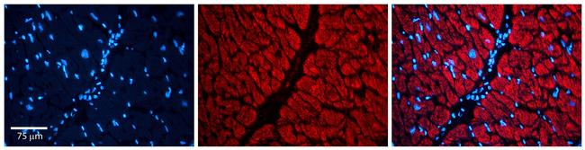 LIS1 Antibody in Immunocytochemistry (ICC/IF)