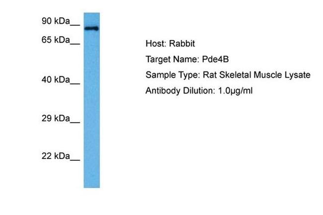 PDE4B Antibody in Western Blot (WB)