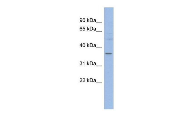 HMGCLL1 Antibody in Western Blot (WB)