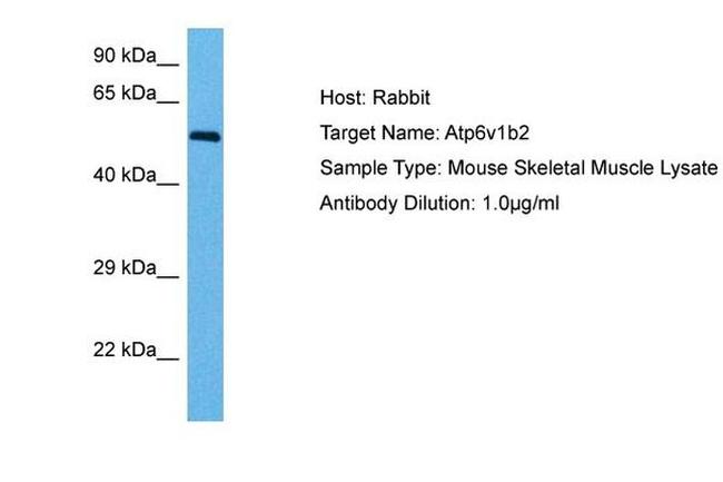 ATP6V1B1 Antibody in Western Blot (WB)