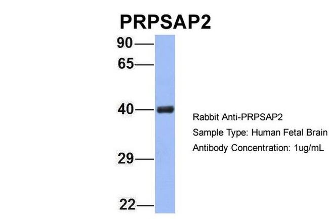 PRPSAP2 Antibody in Western Blot (WB)