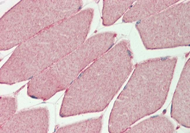 PHKG1 Antibody in Immunohistochemistry (Paraffin) (IHC (P))