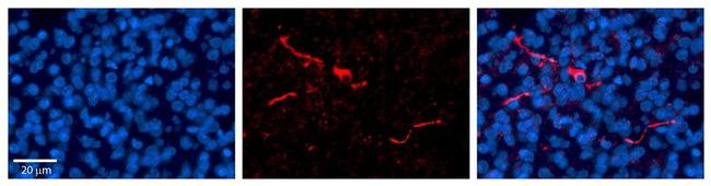 Carboxypeptidase E Antibody in Immunohistochemistry (IHC)