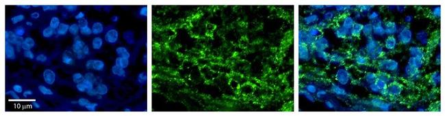 DLD Antibody in Immunohistochemistry (Paraffin) (IHC (P))