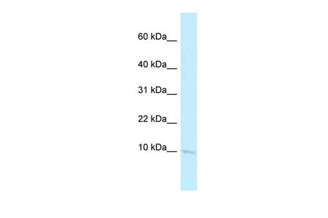 BANF2 Antibody in Western Blot (WB)