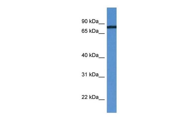 HHIPL1 Antibody in Western Blot (WB)