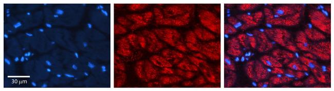 Cathepsin C Antibody in Immunohistochemistry (Paraffin) (IHC (P))