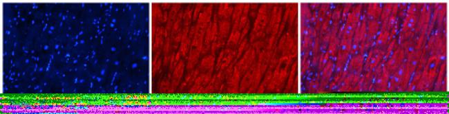 LPL Antibody in Immunocytochemistry (ICC/IF)