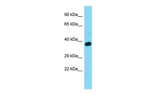 TOM1L1 Antibody in Western Blot (WB)