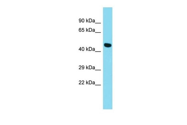 GPR52 Antibody in Western Blot (WB)