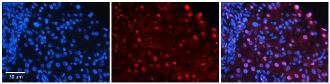 Moesin Antibody in Immunohistochemistry (IHC)