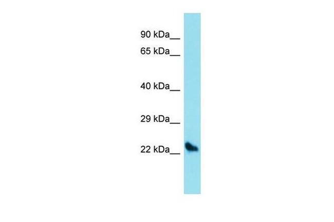 Sostdc1 Antibody in Western Blot (WB)