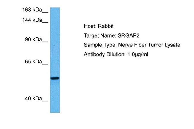 SRGAP2 Antibody in Western Blot (WB)