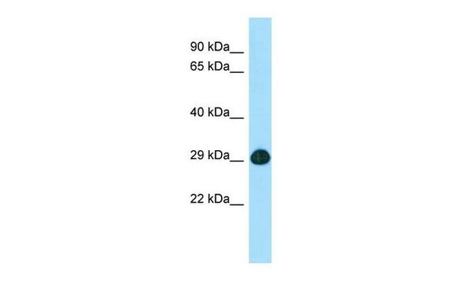 SLC25A2 Antibody in Western Blot (WB)