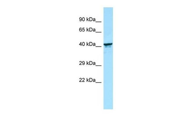 KIR2DL5B Antibody in Western Blot (WB)