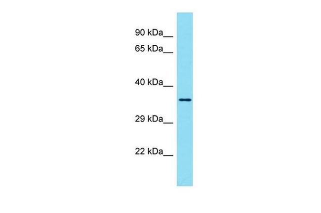 YOD1 Antibody in Western Blot (WB)