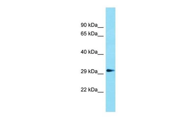 Gdpd1 Antibody in Western Blot (WB)