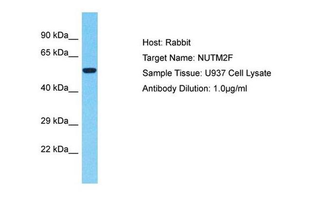 NUTM2F Antibody in Western Blot (WB)