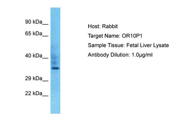 OR10P1 Antibody in Western Blot (WB)