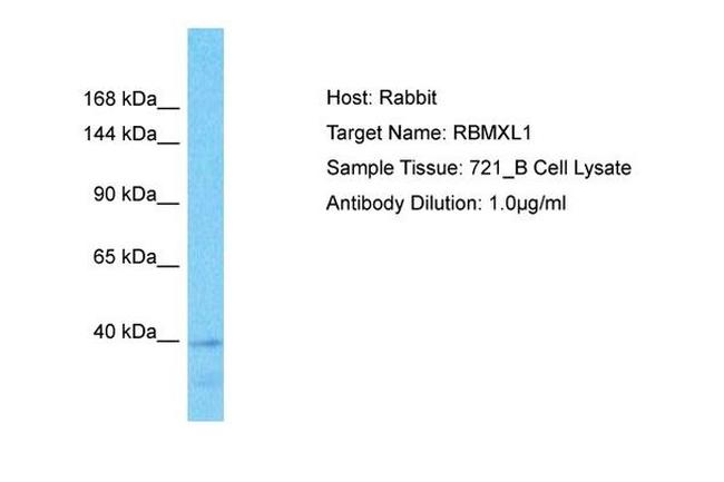 RBMXL1 Antibody in Western Blot (WB)