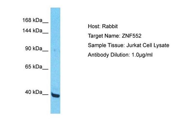 ZNF552 Antibody in Western Blot (WB)