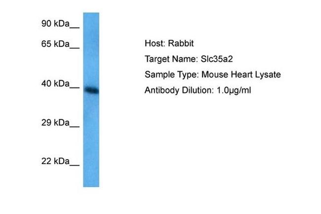 SLC35A2 Antibody in Western Blot (WB)