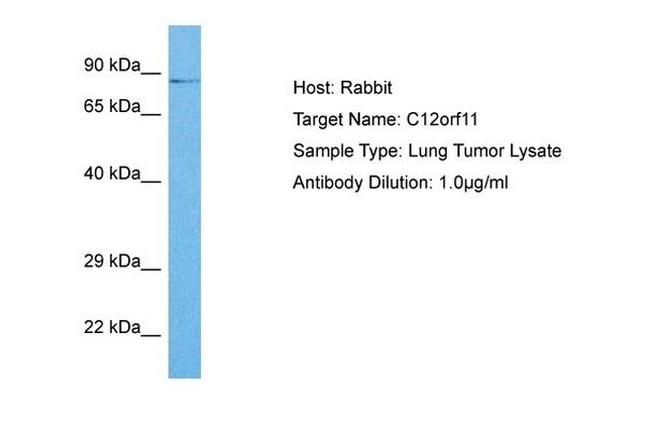 C12orf11 Antibody in Western Blot (WB)