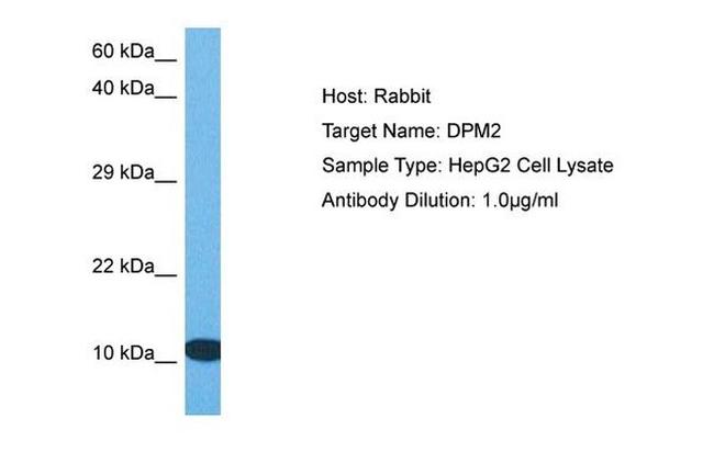 DPM2 Antibody in Western Blot (WB)