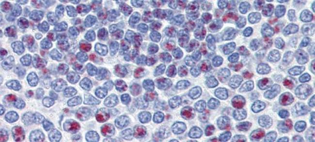 FOXM1 Antibody in Immunohistochemistry (IHC)