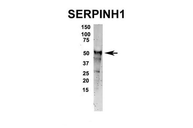 SERPINH1 Antibody in Western Blot (WB)