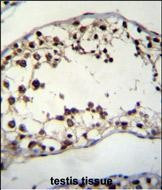 PIH1D2 Antibody in Immunohistochemistry (Paraffin) (IHC (P))