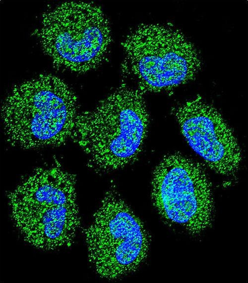 PRAMEF6 Antibody in Immunocytochemistry (ICC/IF)