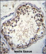 OVOS2 Antibody in Immunohistochemistry (Paraffin) (IHC (P))