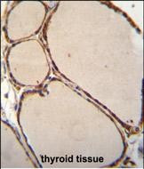 NFKBID Antibody in Immunohistochemistry (Paraffin) (IHC (P))