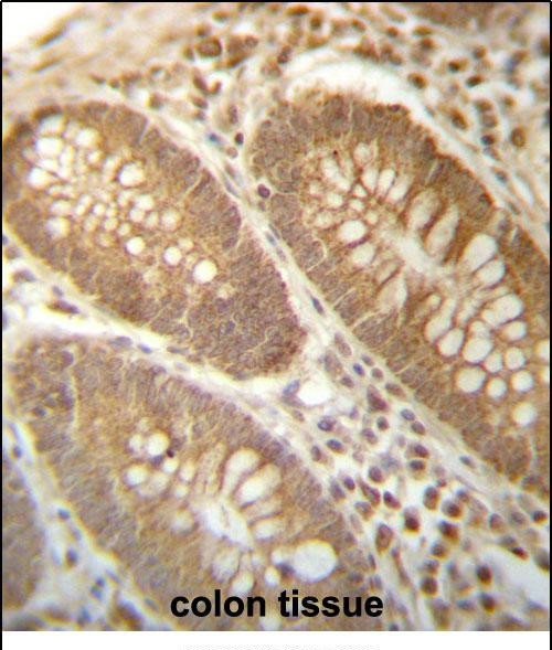 PGAM4 Antibody in Immunohistochemistry (Paraffin) (IHC (P))