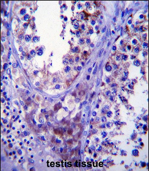 SDF2L1 Antibody in Immunohistochemistry (Paraffin) (IHC (P))