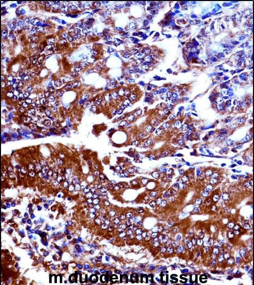 NPR1 Antibody in Immunohistochemistry (Paraffin) (IHC (P))