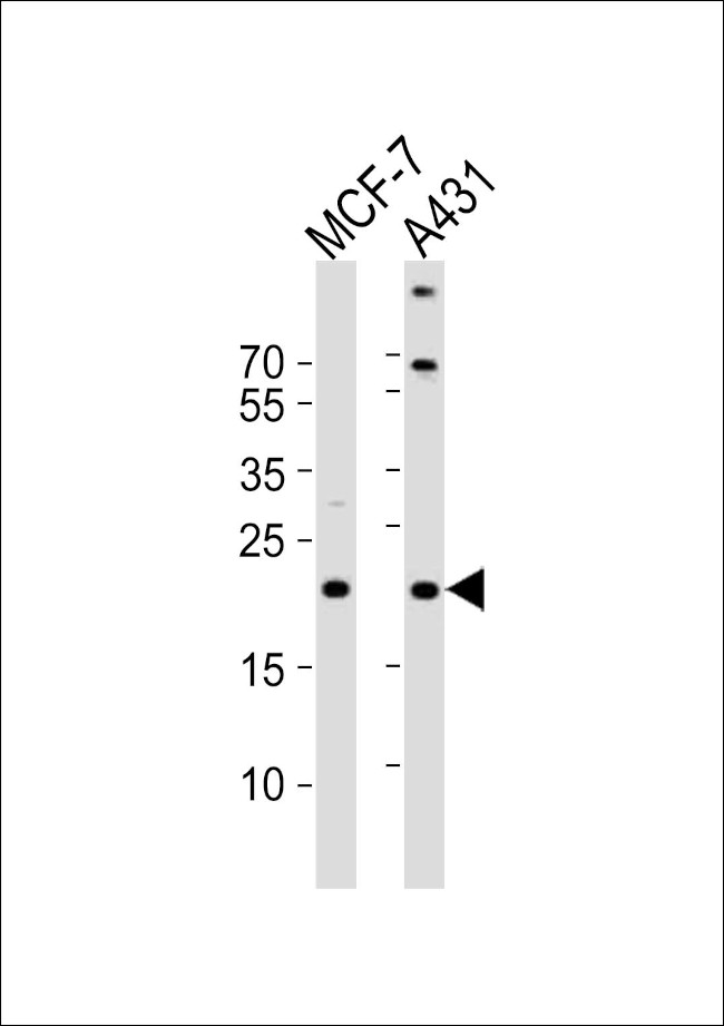 TIMM23 Antibody in Western Blot (WB)