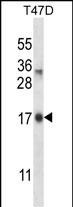 IGF2-AS Antibody in Western Blot (WB)