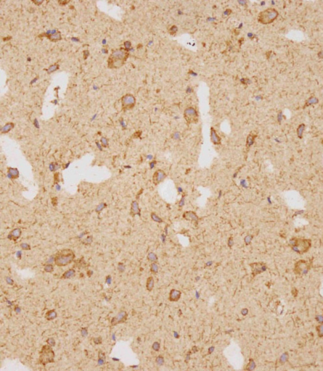 GATSL2 Antibody in Immunohistochemistry (Paraffin) (IHC (P))