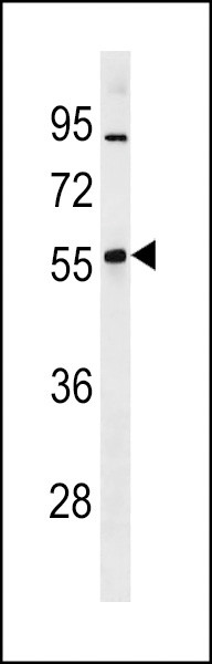 ZNF260 Antibody in Western Blot (WB)