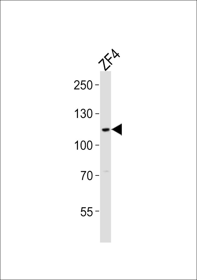 SH3BP4A Antibody in Western Blot (WB)