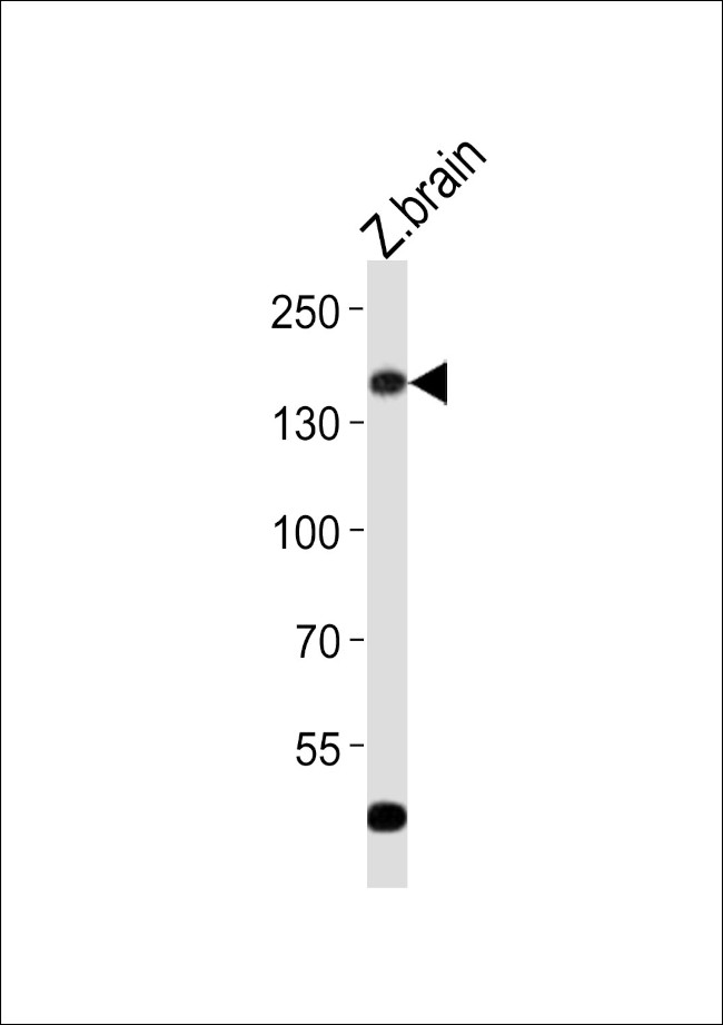 GPR126 Antibody in Western Blot (WB)