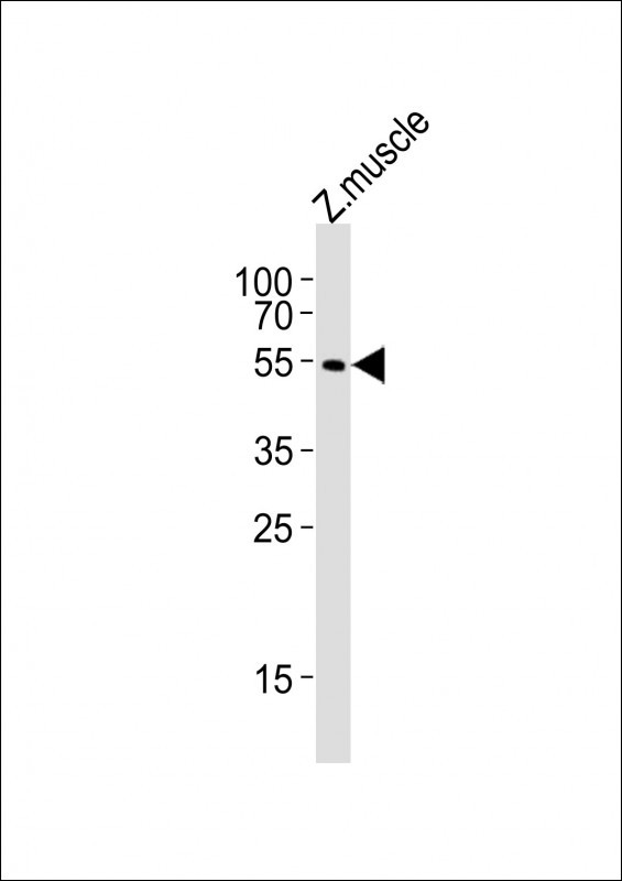 alpha-2a Adrenergic Receptor Antibody in Western Blot (WB)