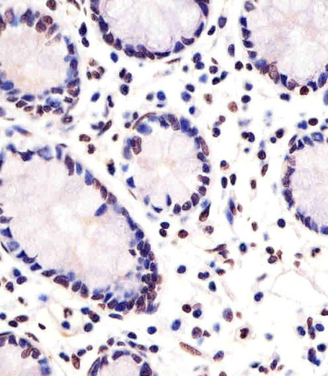 FEV Antibody in Immunohistochemistry (Paraffin) (IHC (P))