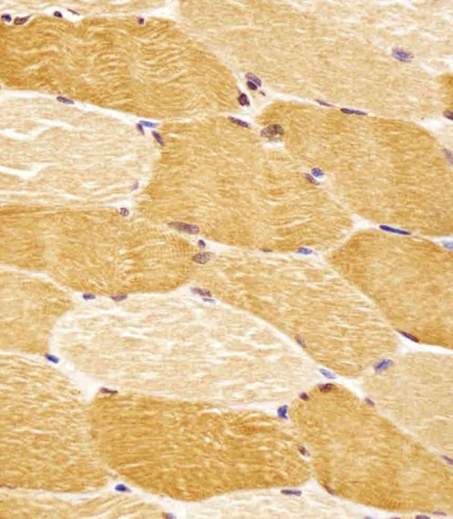 ENT2 Antibody in Immunohistochemistry (Paraffin) (IHC (P))