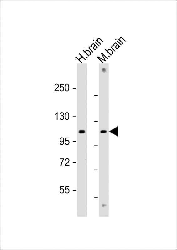 GBA2 Antibody in Western Blot (WB)