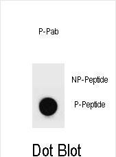 Phospho-MYH9 (Tyr158) Antibody in Dot Blot (DB)